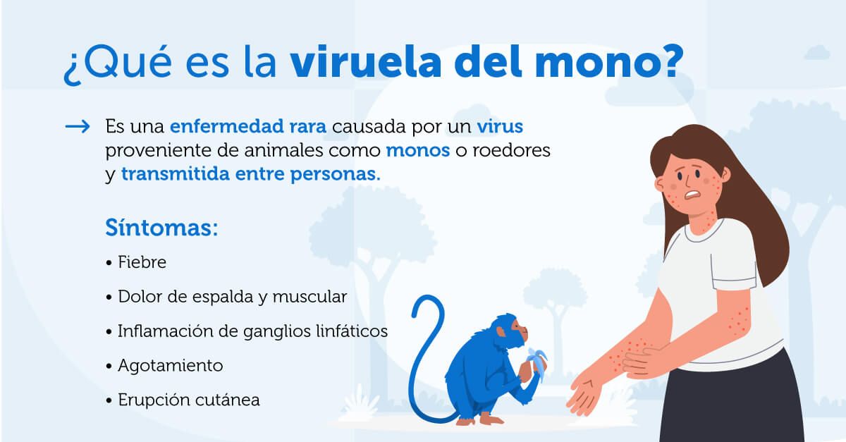 Infografía viruela del mono