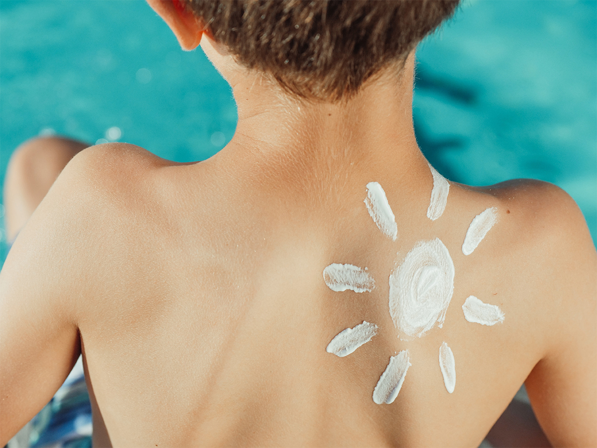 Prevenir las quemaduras solares